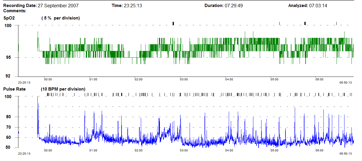 Oximetry